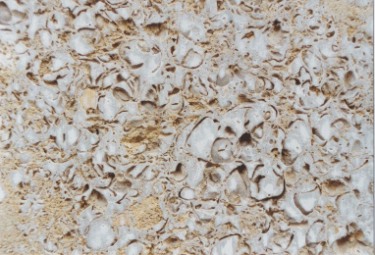 Muschelkalk (Forum am Brhl)